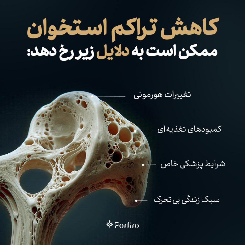 اینفوگرافیک دلایل کاهش تراکم استخوان