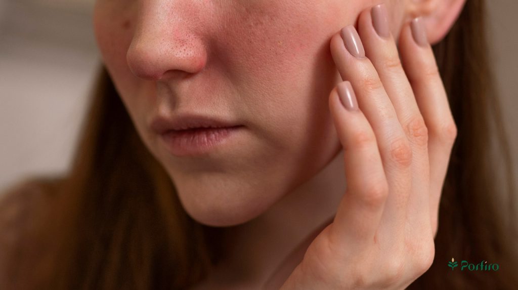 ویژگیهای پوست حساس