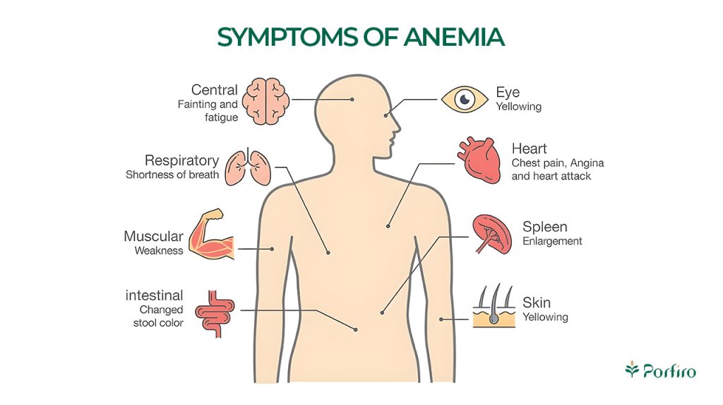 symptoms of anemia