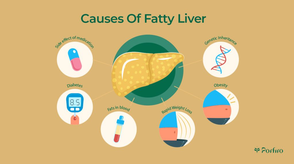 Infographic of the causes and factors that cause fatty liver disease