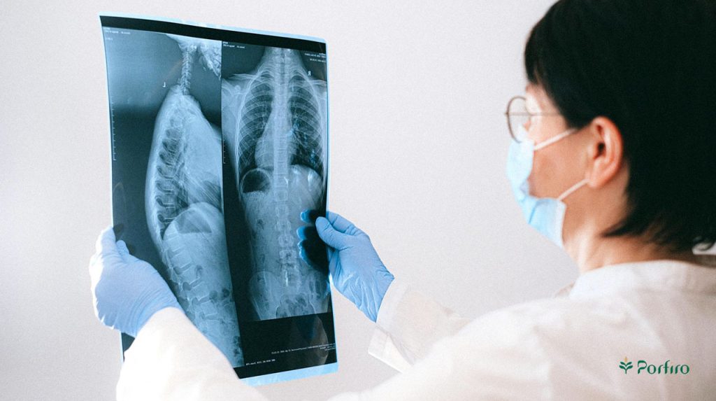 Doctor examining a patient's x-ray