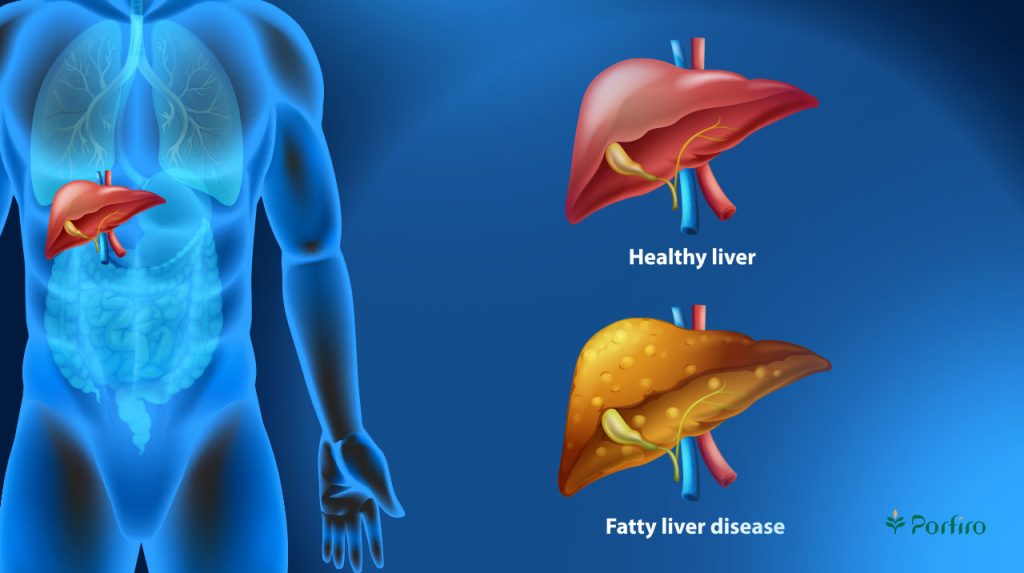 The position of the liver in the body and a comparison of the two types of healthy liver and fatty liver