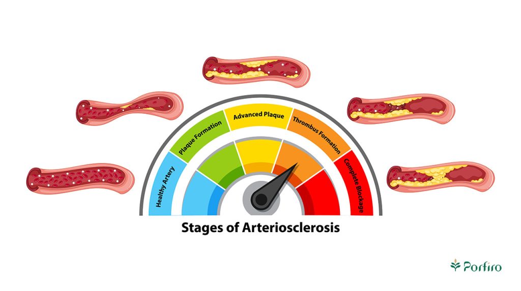 Schematic representation of the stages of cholesterol production.