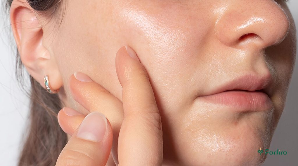 Cheek of a woman with oily skin