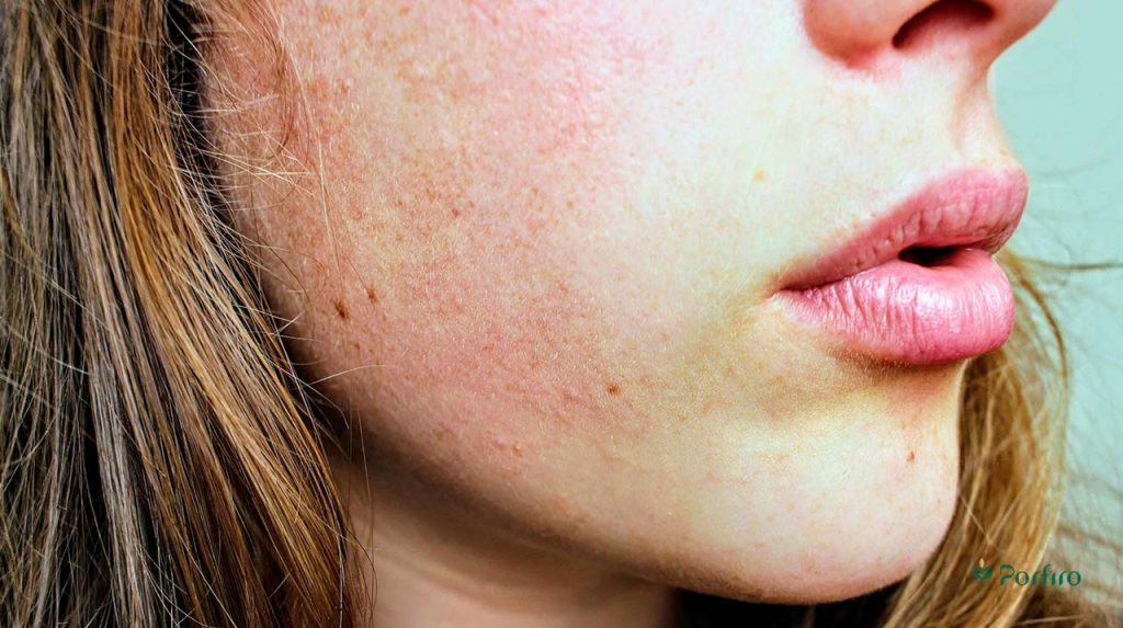 The face of a woman with sensitive skin