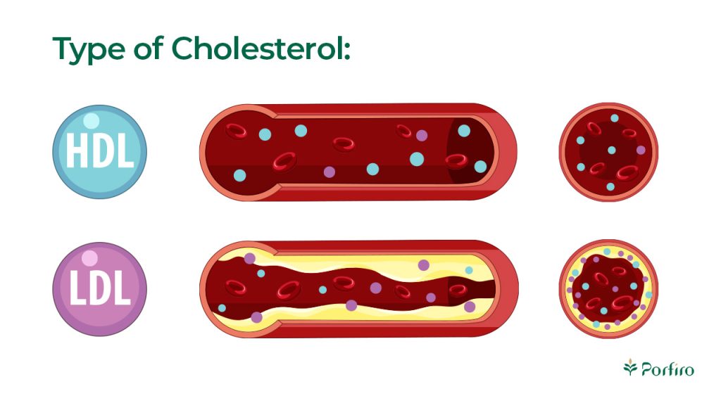 Schematic illustration of the types of cholesterol