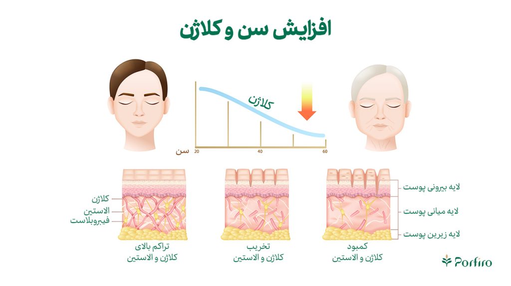اینفوگرافیک اثرات افزایش سن و کلاژن