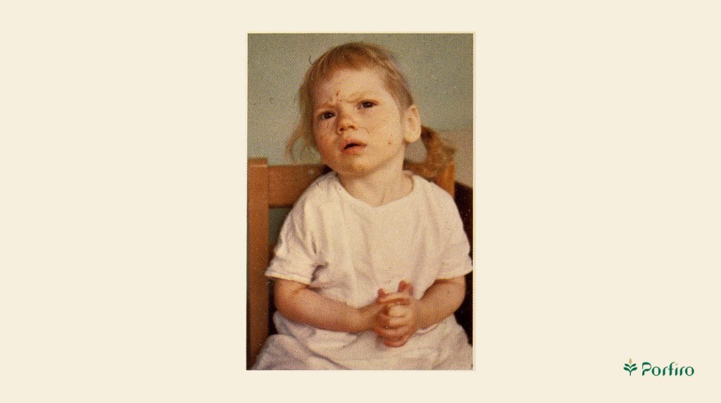 Little girl with phenylketonuria