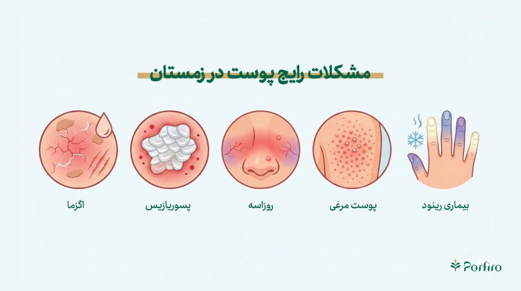 اینفوگرافیک مشکلات رایج مراقبت از پوست در زمستان